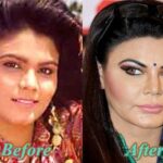 Rakhi-Sawant-before-and-after-Cosmetic-Surgery